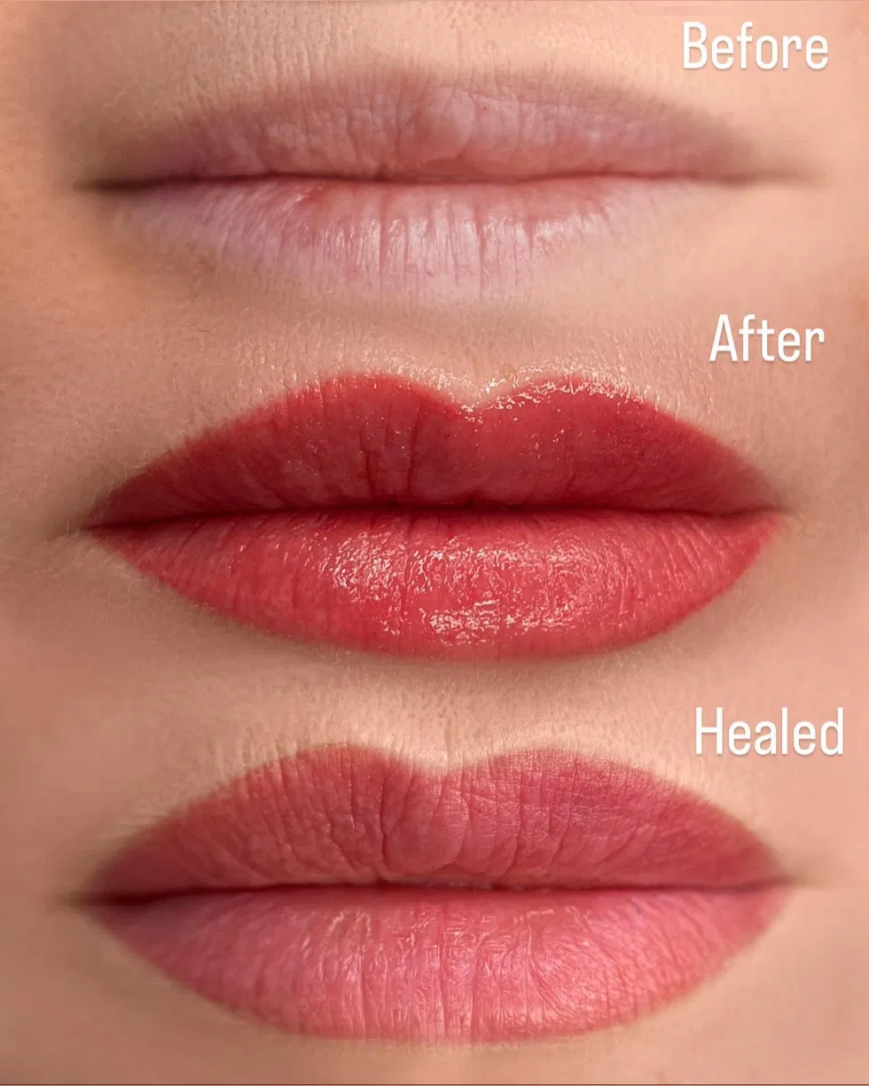 PMU Before, After & Healed – läppar